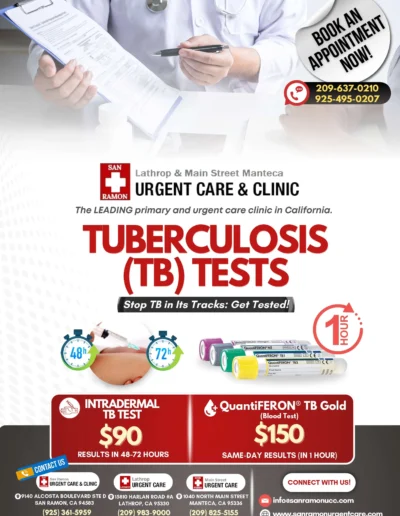 TB Tests